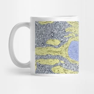 Hippocampus neuron, TEM (C029/8222) Mug